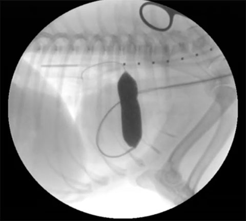 Cases of pulmonic stenosis with different causes – the value of multimodal imaging