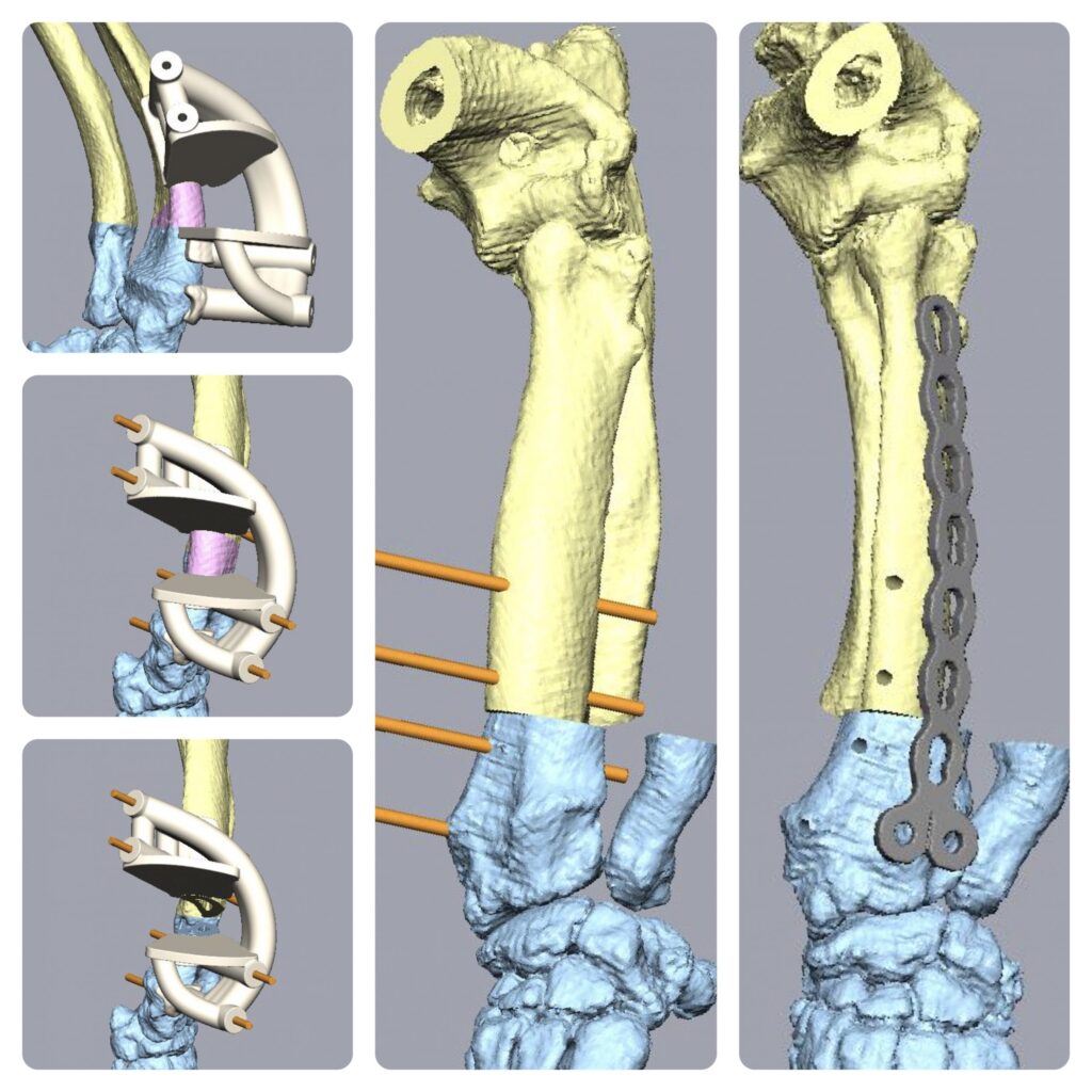 Our orthopaedic surgeons can do some amazing things!